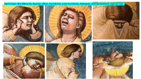 Douleur, Giotto - Lettren°2